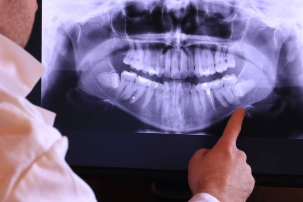 Best Emergency Tooth Extraction in Mountainside, NJ