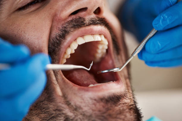 Best Walk-In Emergency Dentist in Mountainside, NJ