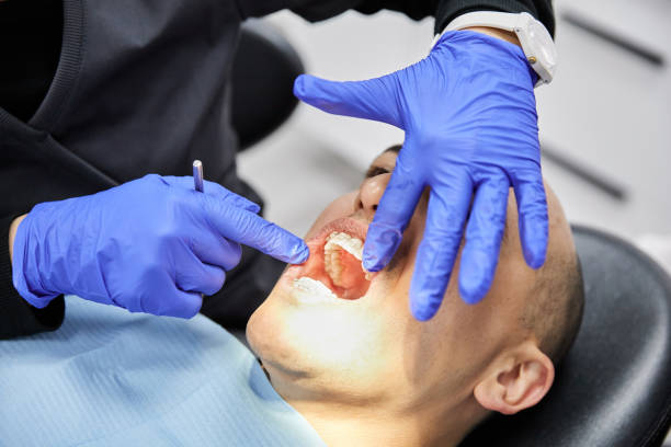 Best Emergency Root Canal Treatment in Mountainside, NJ
